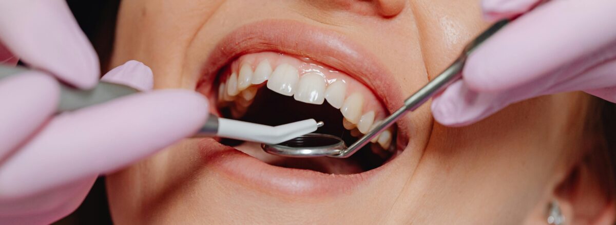 douleur après soin dentaire